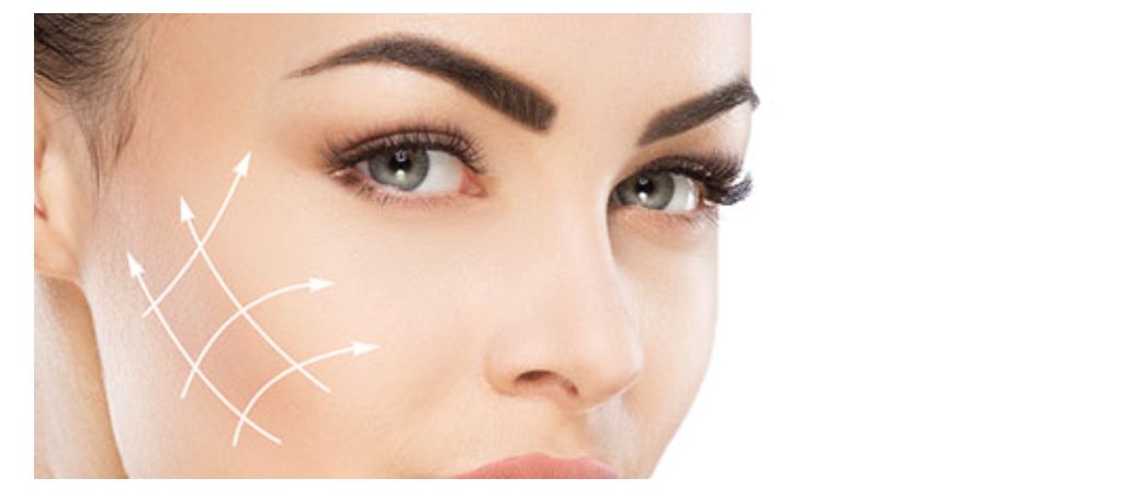 BOTOX - Lower Face Lift