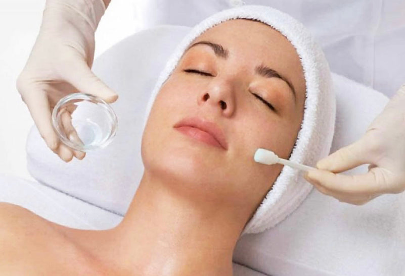 Chemical Peels - Light Peel