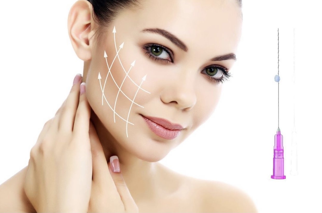 PDO Thread Face Lifting-Full Face Thread Lifting