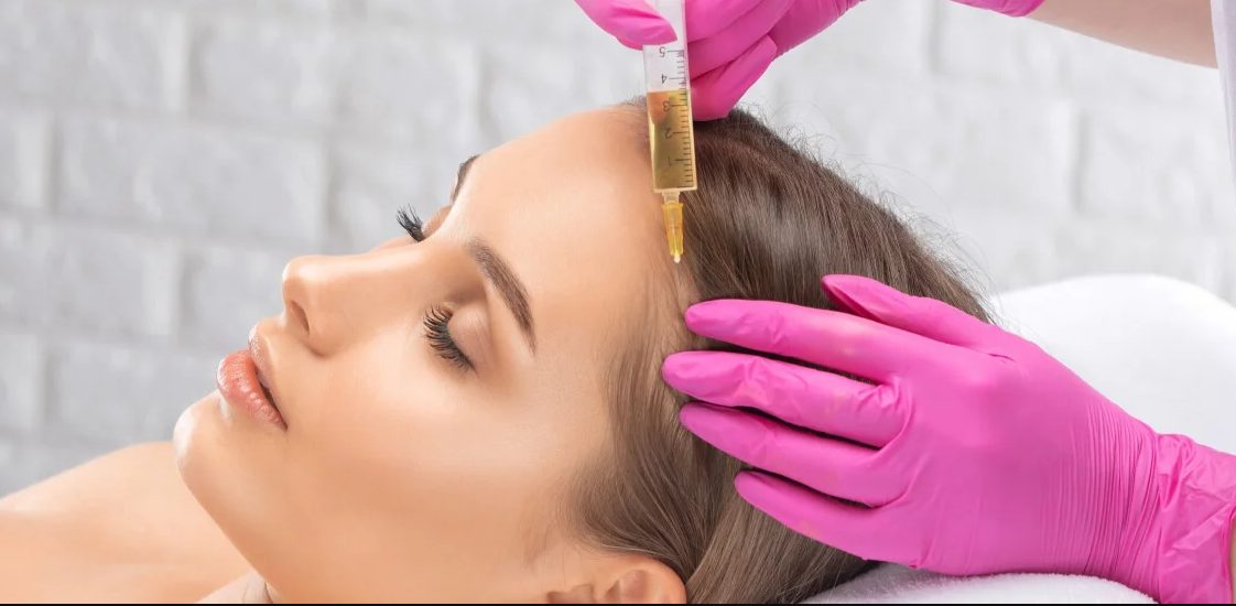 PRP - Hair Restoration